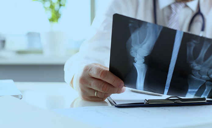 #ParaTodosVerem: Médico com jaleco branco e estetoscópio no pescoço analisa uma radiografia do braço e punho de um paciente. A imagem é observada sobre uma mesa com papéis e uma prancheta. Ao fundo, o consultório aparece claro e desfocado.